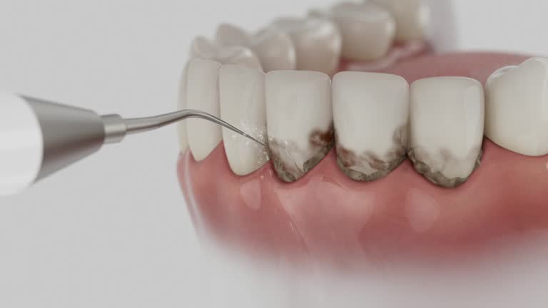 Trusted Emergency Dentist service in Spring Arbor, MI - Dentist Open Now